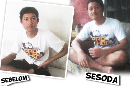 Sebelum dan Sesudah