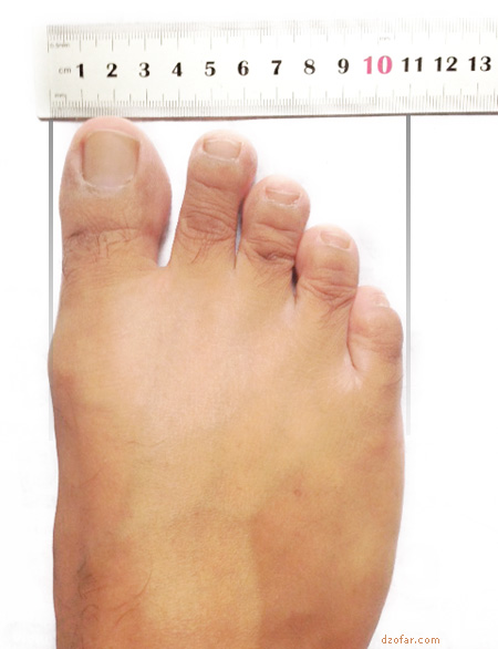 Kaki lebar